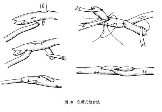 ④肌腱-骨缝合方法:适用于肌腱止于骨上的缝合(图19).