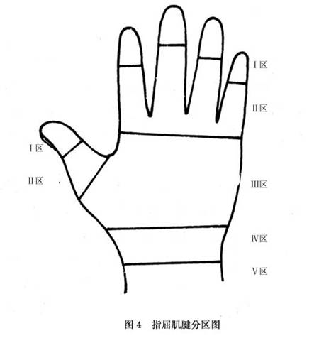 手部屈指肌腱损伤