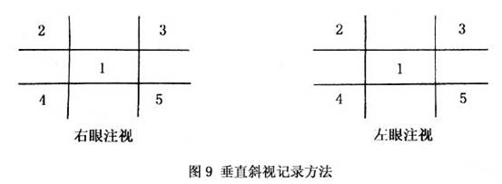 麻痹性斜视