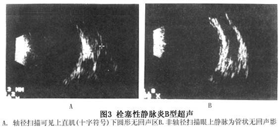 GE发布新一代便携式可视化视诊仪