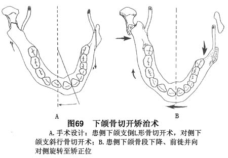 牙颌面畸形_牙颌面畸形的症状_牙颌面畸形治疗_导医网