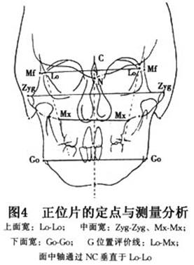 牙颌面畸形